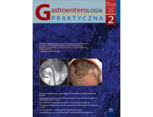 Gastroenterologia Praktyczna 2/2016
