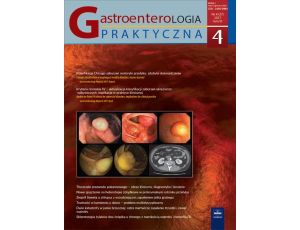 Gastroenterologia Praktyczna 4/2017